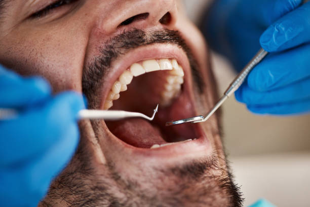 Best Laser Dentistry  in Rossville, TN